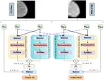 MV-Swin-T: Mammogram Classification with Multi-view Swin Transformer